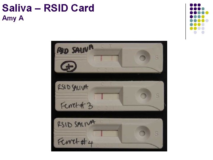 Saliva – RSID Card Amy A 