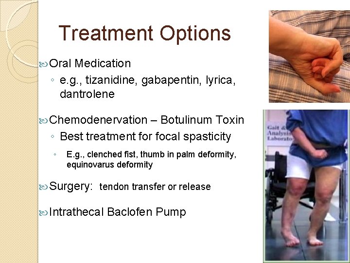 Treatment Options Oral Medication ◦ e. g. , tizanidine, gabapentin, lyrica, dantrolene Chemodenervation –