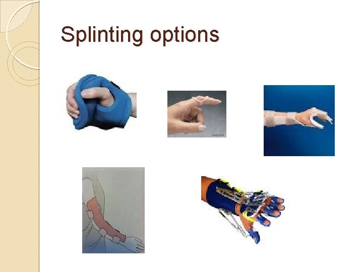 Splinting options 