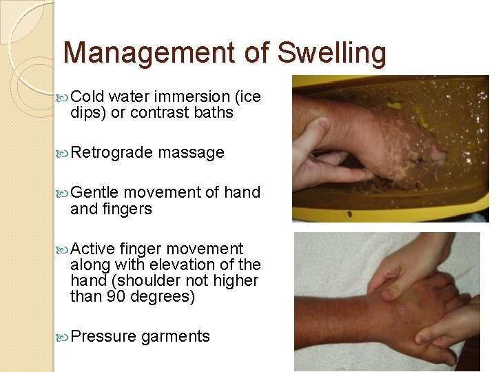 Management of Swelling Cold water immersion (ice dips) or contrast baths Retrograde massage Gentle