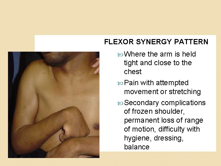 FLEXOR SYNERGY PATTERN Where the arm is held tight and close to the chest