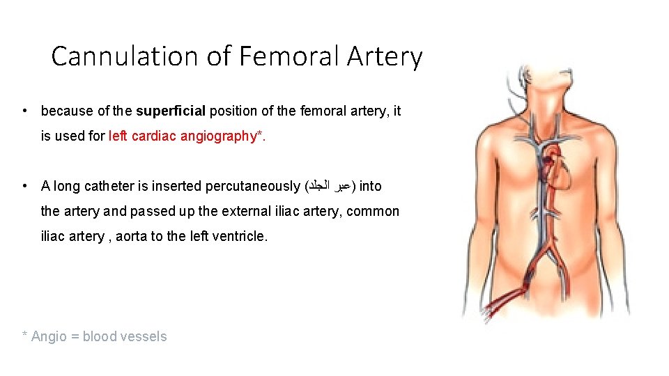 Cannulation of Femoral Artery • because of the superficial position of the femoral artery,