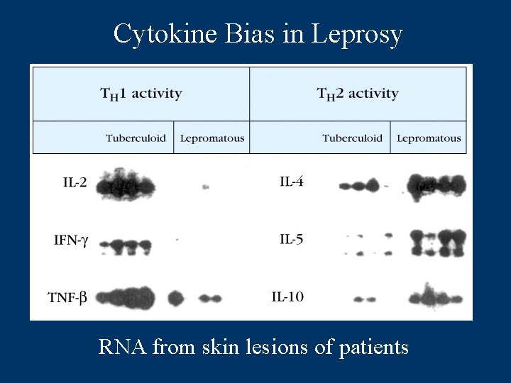 Cytokine Bias in Leprosy RNA from skin lesions of patients 