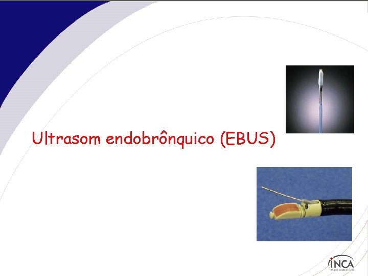 Ultrasom endobrônquico (EBUS) 