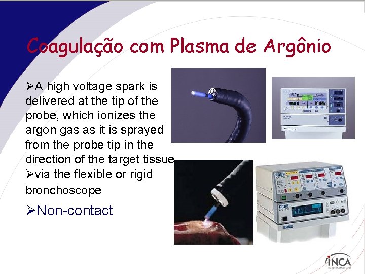 Coagulação com Plasma de Argônio ØA high voltage spark is delivered at the tip
