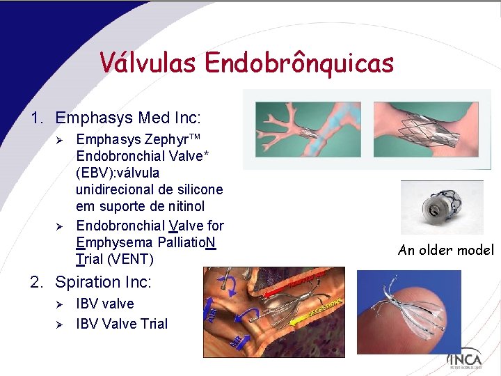Válvulas Endobrônquicas 1. Emphasys Med Inc: Ø Ø Emphasys Zephyr™ Endobronchial Valve* (EBV): válvula