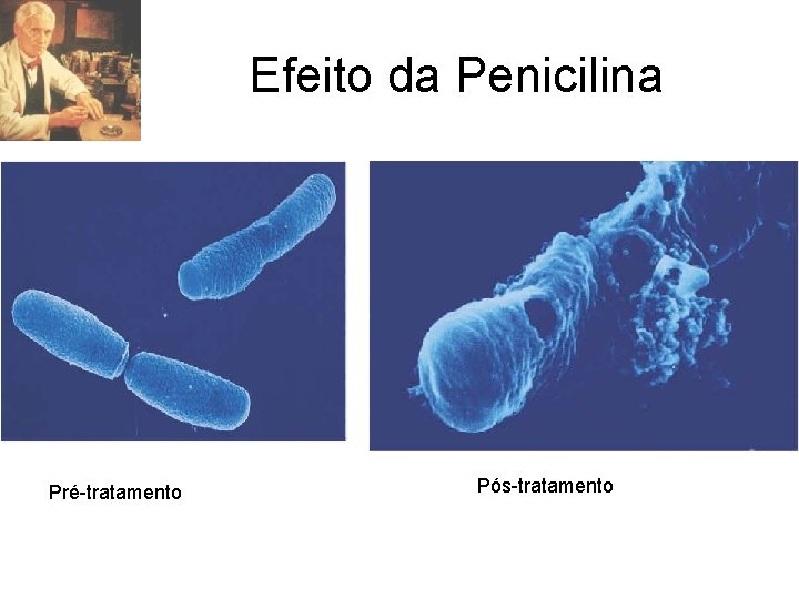 Efeito da Penicilina Pré-tratamento Pós-tratamento 