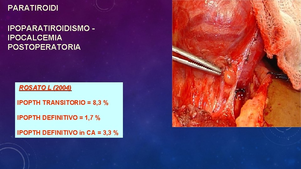 PARATIROIDI IPOPARATIROIDISMO IPOCALCEMIA POSTOPERATORIA ROSATO L (2004) IPOPTH TRANSITORIO = 8, 3 % IPOPTH