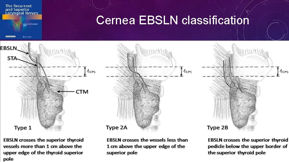 Cernea EBSLN classification 