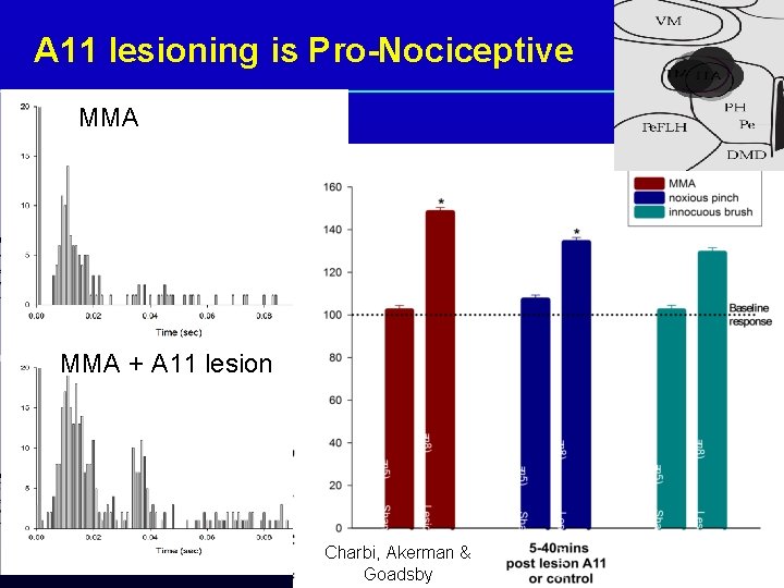 A 11 lesioning is Pro-Nociceptive MMA + A 11 lesion Charbi, Akerman & Goadsby