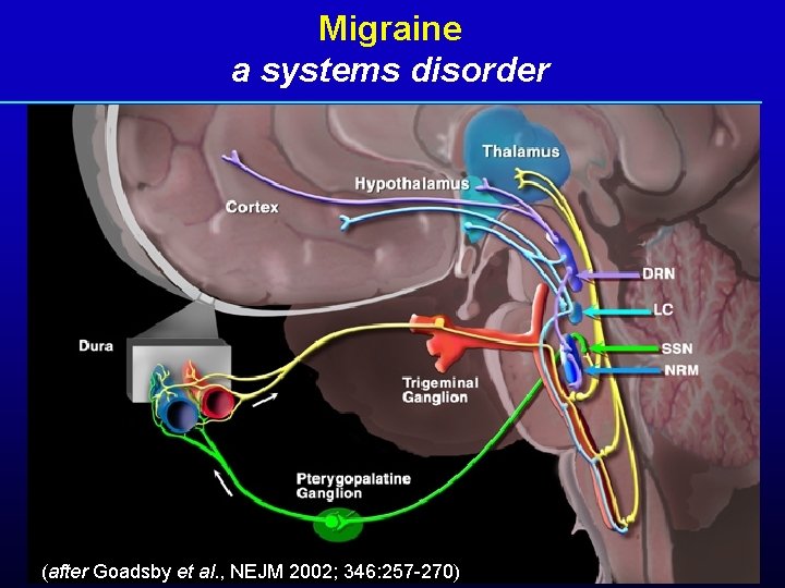 Migraine a systems disorder (after Goadsby et al. , NEJM 2002; 346: 257 -270)