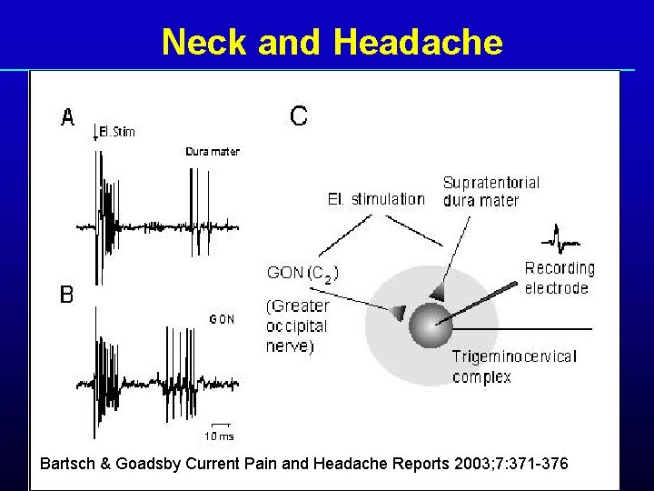 Neck and Headache Bartsch & Goadsby Current Pain and Headache Reports 2003; 7: 371