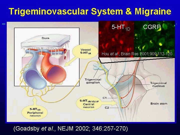 Trigeminovascular System & Migraine 5 -HT 1 D CGRP Hou et al. , Brain