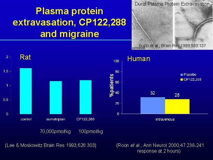 Plasma protein extravasation, CP 122, 288 and migraine Dural Plasma Protein Extravasation Buzzi et