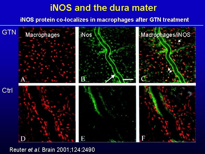 i. NOS and the dura mater i. NOS protein co-localizes in macrophages after GTN