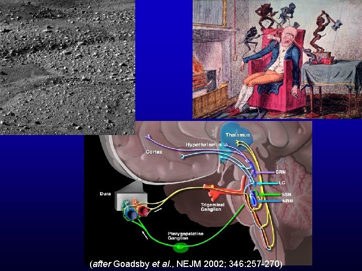 (after Goadsby et al. , NEJM 2002; 346: 257 -270) 