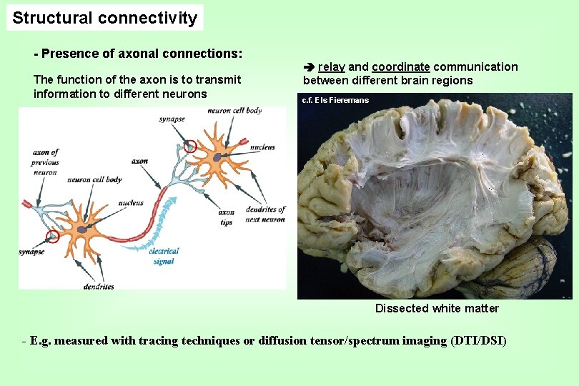 Structural connectivity - Presence of axonal connections: The function of the axon is to