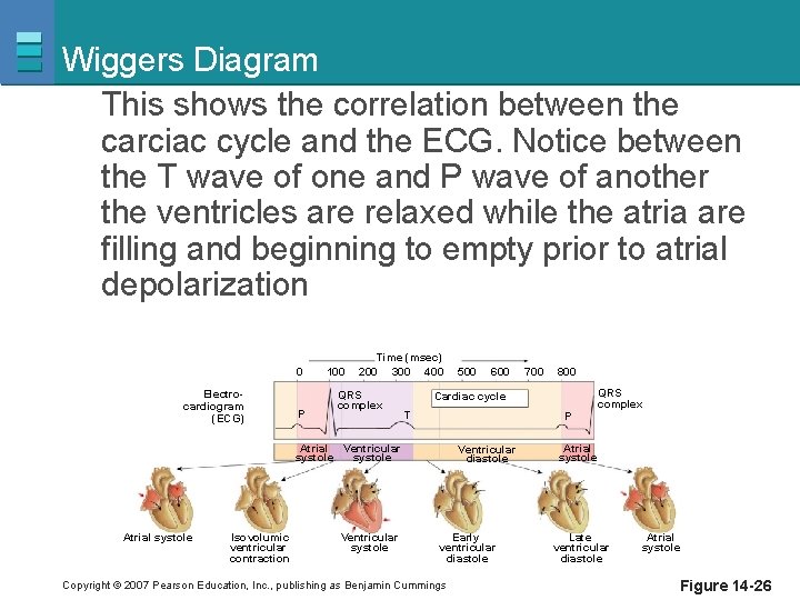 Wiggers Diagram This shows the correlation between the carciac cycle and the ECG. Notice