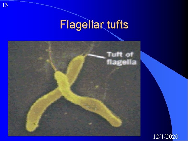 13 Flagellar tufts 12/1/2020 