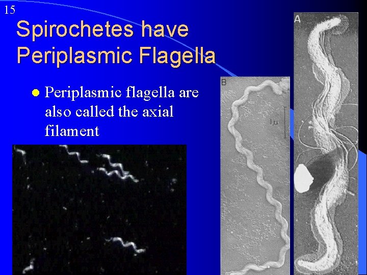 15 Spirochetes have Periplasmic Flagella l Periplasmic flagella are also called the axial filament