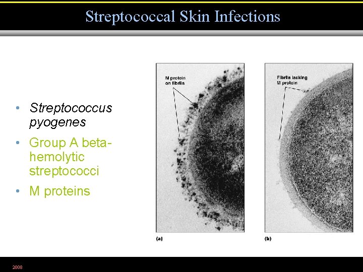 Streptococcal Skin Infections • Streptococcus pyogenes • Group A betahemolytic streptococci • M proteins