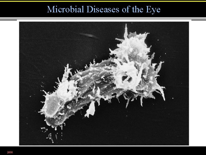 Microbial Diseases of the Eye 2008 Figure 21. 21 