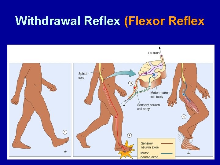 Withdrawal Reflex (Flexor Reflex 