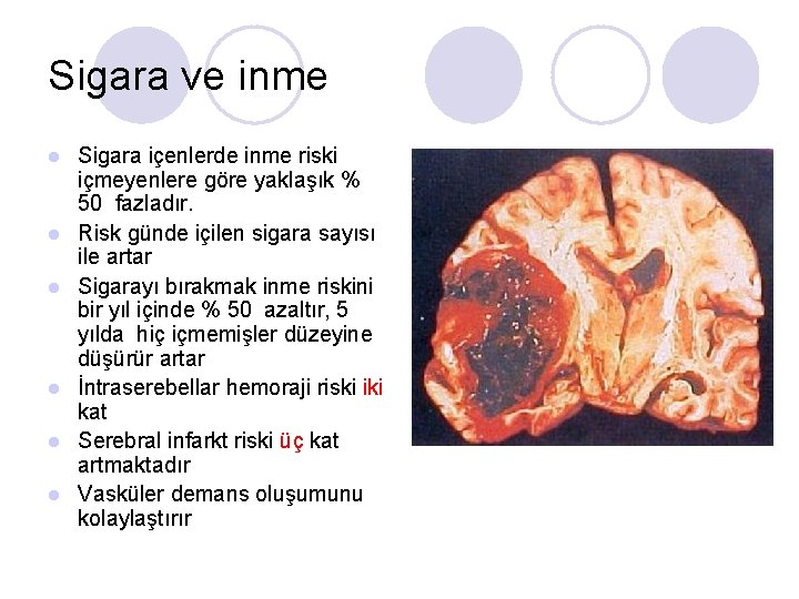 Sigara ve inme l l l Sigara içenlerde inme riski içmeyenlere göre yaklaşık %