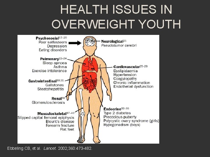 HEALTH ISSUES IN OVERWEIGHT YOUTH Ebbeling CB, et al. Lancet. 2002; 360: 473 -482.