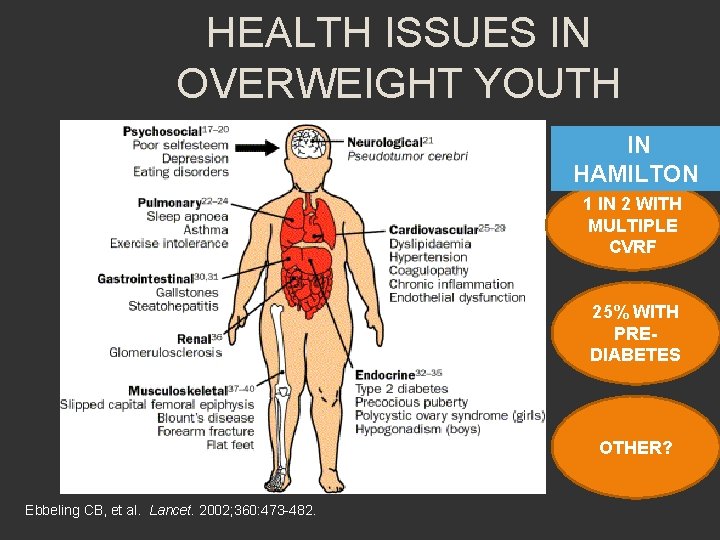 HEALTH ISSUES IN OVERWEIGHT YOUTH IN HAMILTON 1 IN 2 WITH MULTIPLE CVRF 25%