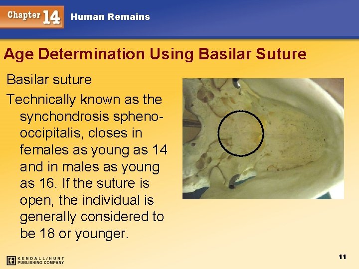 Human Remains Age Determination Using Basilar Suture Basilar suture Technically known as the synchondrosis