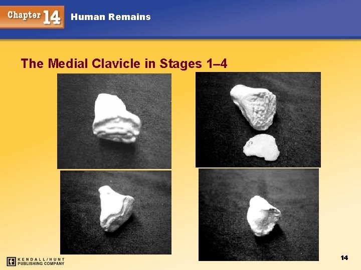 Human Remains The Medial Clavicle in Stages 1– 4 14 