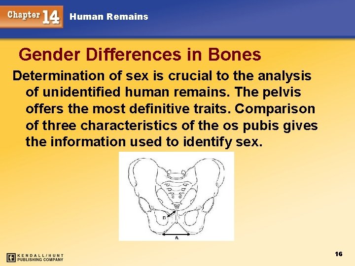 Human Remains Gender Differences in Bones Determination of sex is crucial to the analysis