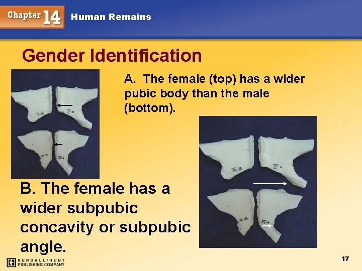 Human Remains Gender Identification A. The female (top) has a wider pubic body than