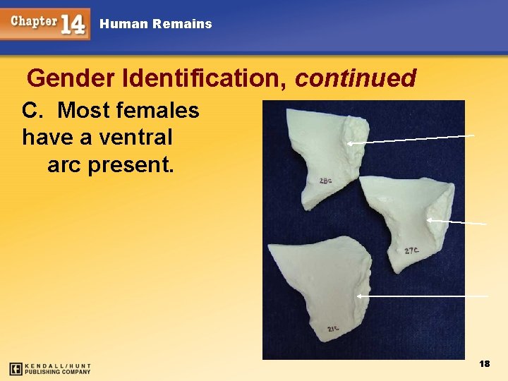 Human Remains Gender Identification, continued C. Most females have a ventral arc present. 18