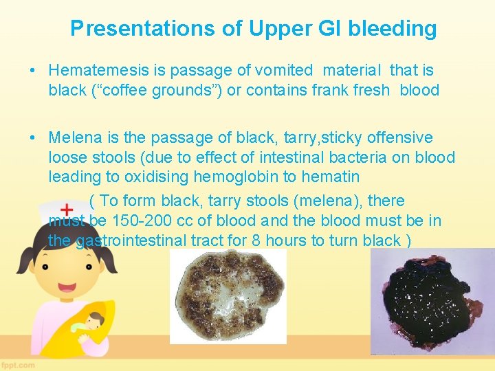 Presentations of Upper GI bleeding • Hematemesis is passage of vomited material that is