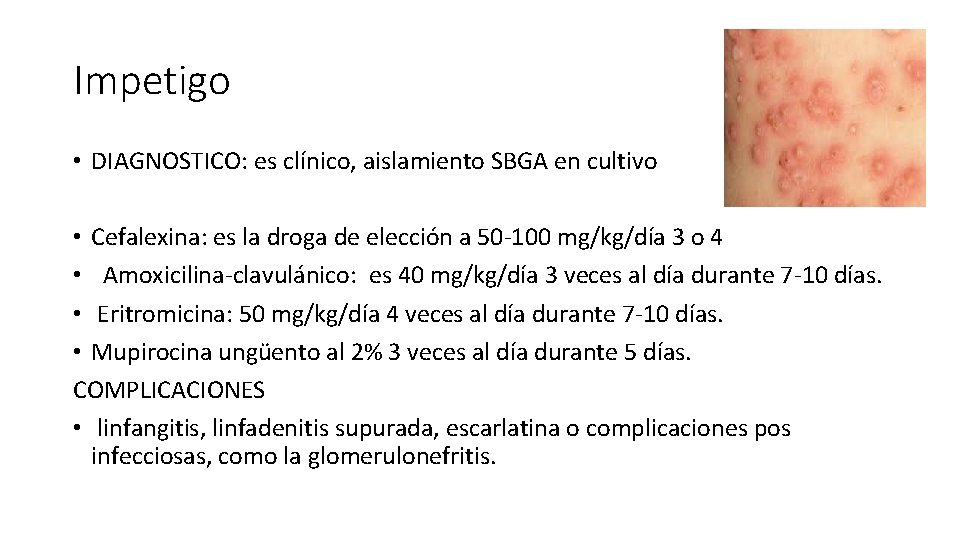 Impetigo • DIAGNOSTICO: es clínico, aislamiento SBGA en cultivo • Cefalexina: es la droga Impetigo • DIAGNOSTICO: es clínico, aislamiento SBGA en cultivo • Cefalexina: es la droga