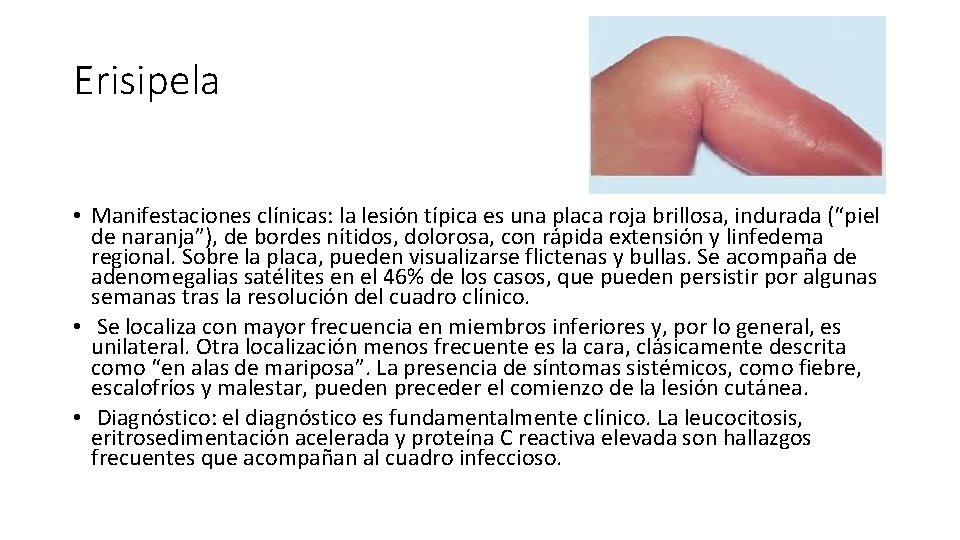Erisipela • Manifestaciones clínicas: la lesión típica es una placa roja brillosa, indurada (“piel
