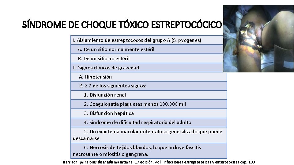 SÍNDROME DE CHOQUE TÓXICO ESTREPTOCÓCICO I. Aislamiento de estreptococos del grupo A (S. pyogenes)