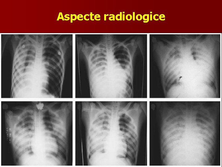 Aspecte radiologice 