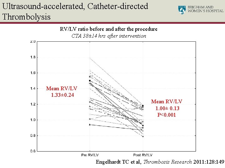 Ultrasound-accelerated, Catheter-directed Thrombolysis RV/LV ratio before and after the procedure CTA 38± 14 hrs