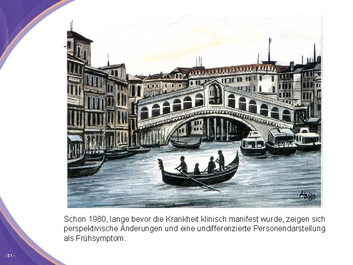 Schon 1980, lange bevor die Krankheit klinisch manifest wurde, zeigen sich perspektivische Änderungen und