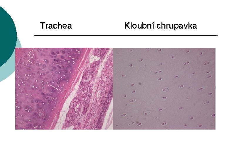 Trachea Kloubní chrupavka 