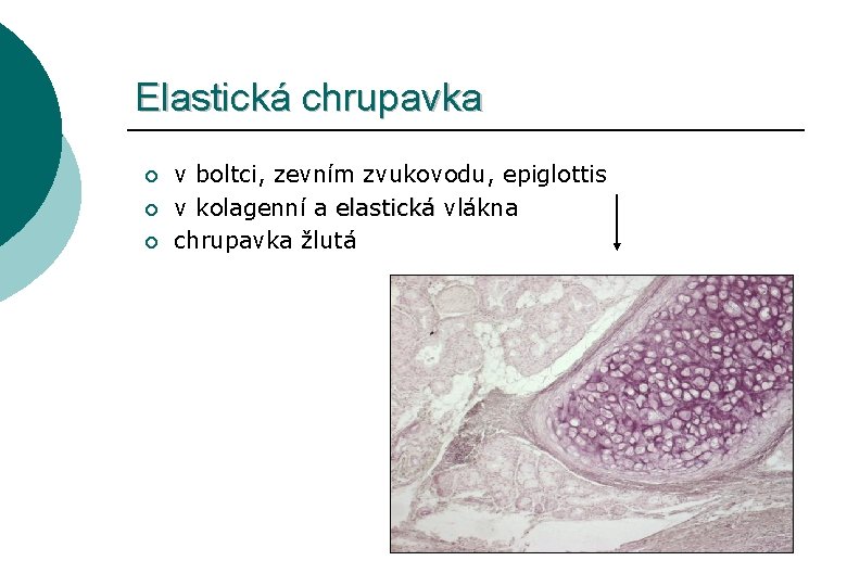 Elastická chrupavka ¡ ¡ ¡ v boltci, zevním zvukovodu, epiglottis v kolagenní a elastická