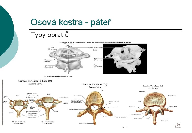 Osová kostra - páteř Typy obratlů 