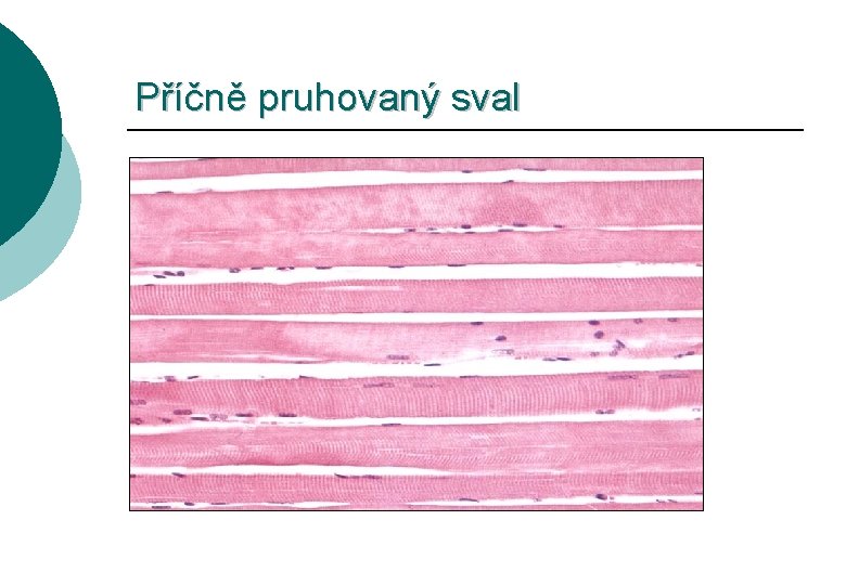 Příčně pruhovaný sval 