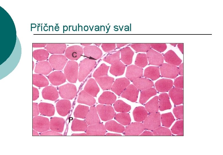 Příčně pruhovaný sval 