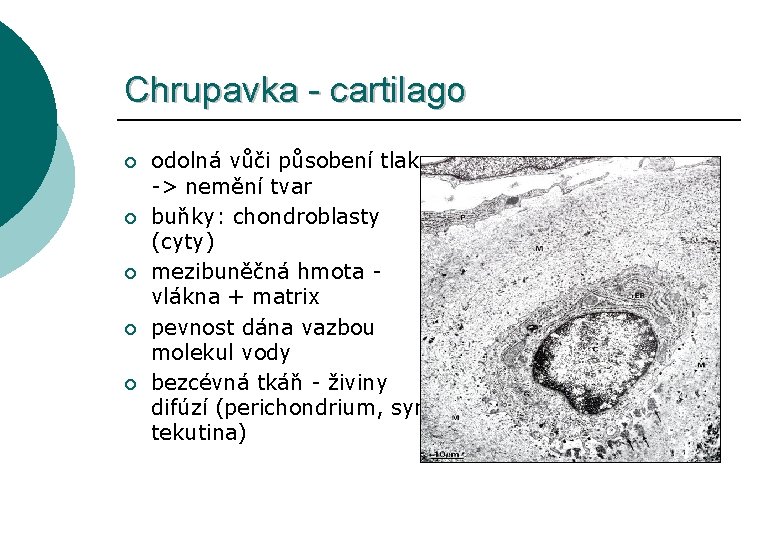 Chrupavka - cartilago ¡ ¡ ¡ odolná vůči působení tlaku -> nemění tvar buňky: