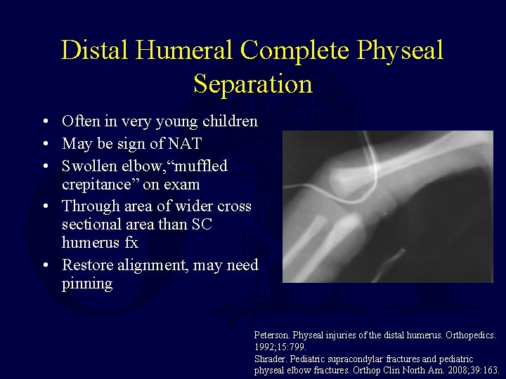 Distal Humeral Complete Physeal Separation • Often in very young children • May be Distal Humeral Complete Physeal Separation • Often in very young children • May be