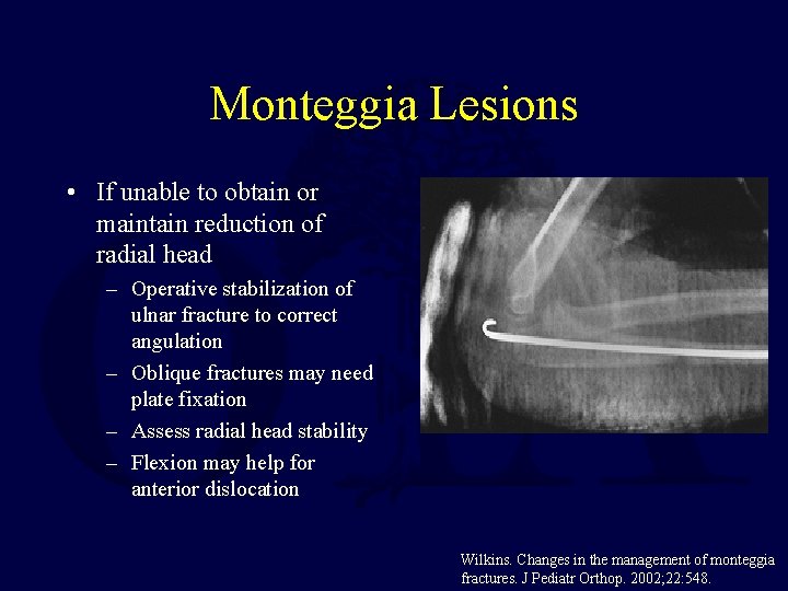 Monteggia Lesions • If unable to obtain or maintain reduction of radial head – Monteggia Lesions • If unable to obtain or maintain reduction of radial head –